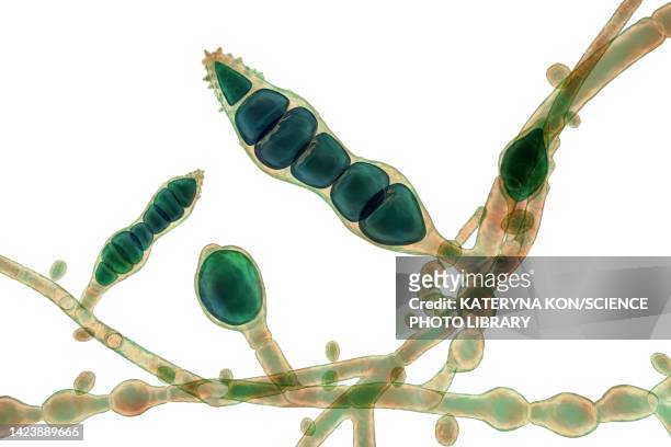 microsporum audouinii fungus, illustration - dermatophyt stock-grafiken, -clipart, -cartoons und -symbole