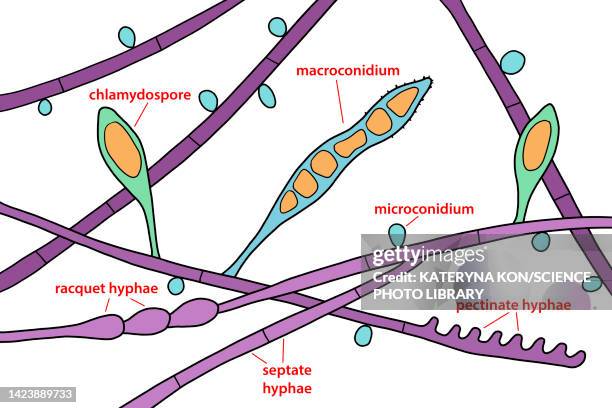 microsporum audouinii fungus, illustration - dermatophyt stock-grafiken, -clipart, -cartoons und -symbole