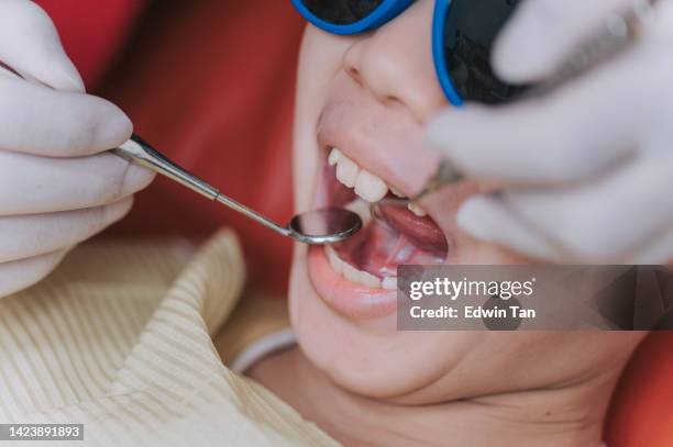 close up asian chinese dentist examine young boy teeth with angled mirror in dentist office - wortelkanaal stockfoto's en -beelden