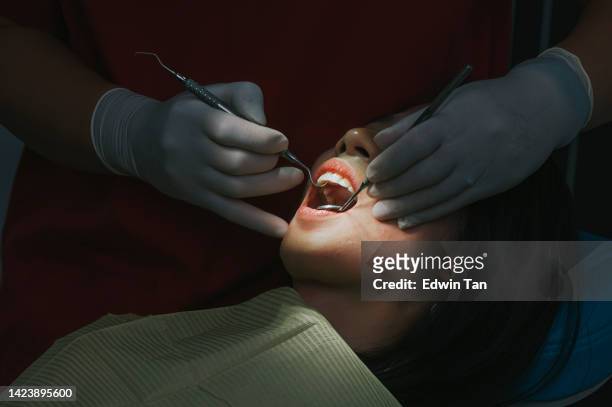 彼女の歯のルーチンのチェックアップを検査歯科医のためのアジアの中国人女性患者の口を開くクローズアップ - endodontist ストックフォトと画像