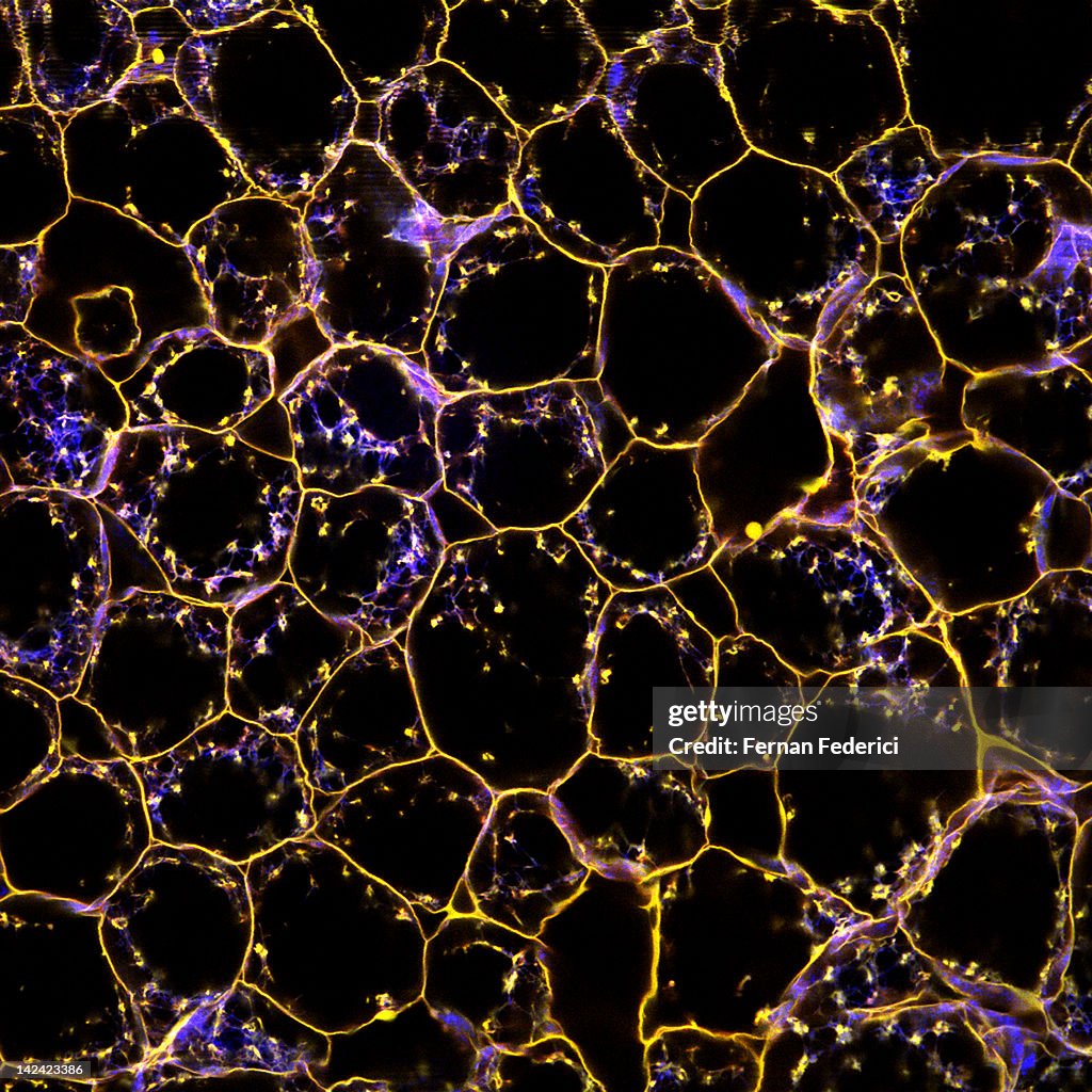 Plant cells