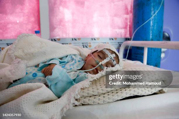 Yemeni child infected with malnutrition is seen at a medical center receiving treatment, on September 14, 2022 in Sana'a, Yemen. As a result of the...