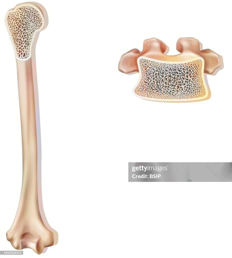 Bone drawing