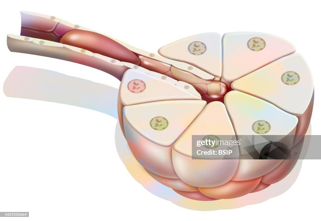 Pancreatitis drawing
