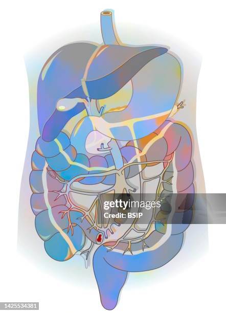 Apendix Drawing 29 Appendix Drawing Stock Photos, High-Res Pictures, and Images - Getty ...