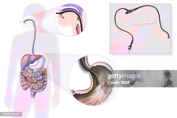stomach endoscopy drawing - human digestive system stock illustrations