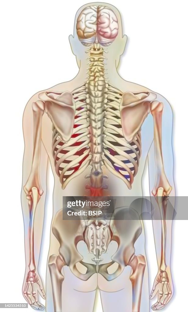 Back pain drawing