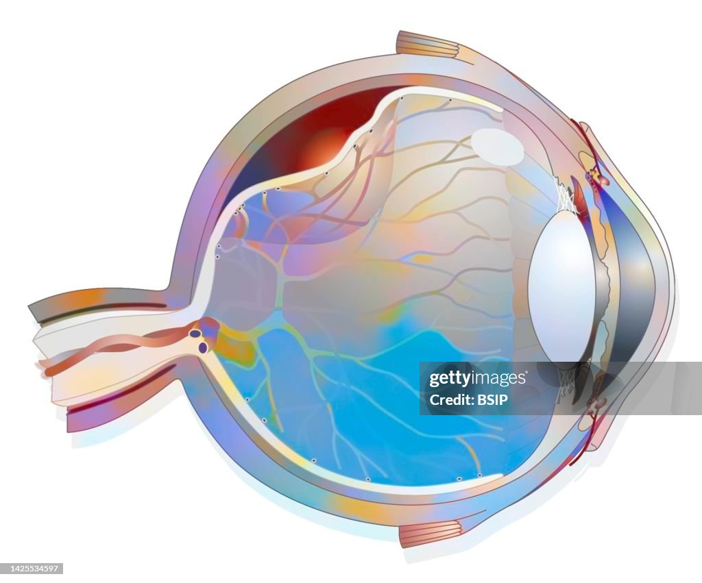 Retina Protection Image Retina Detachment Drawing High-Res Vector Graphic - Getty Images