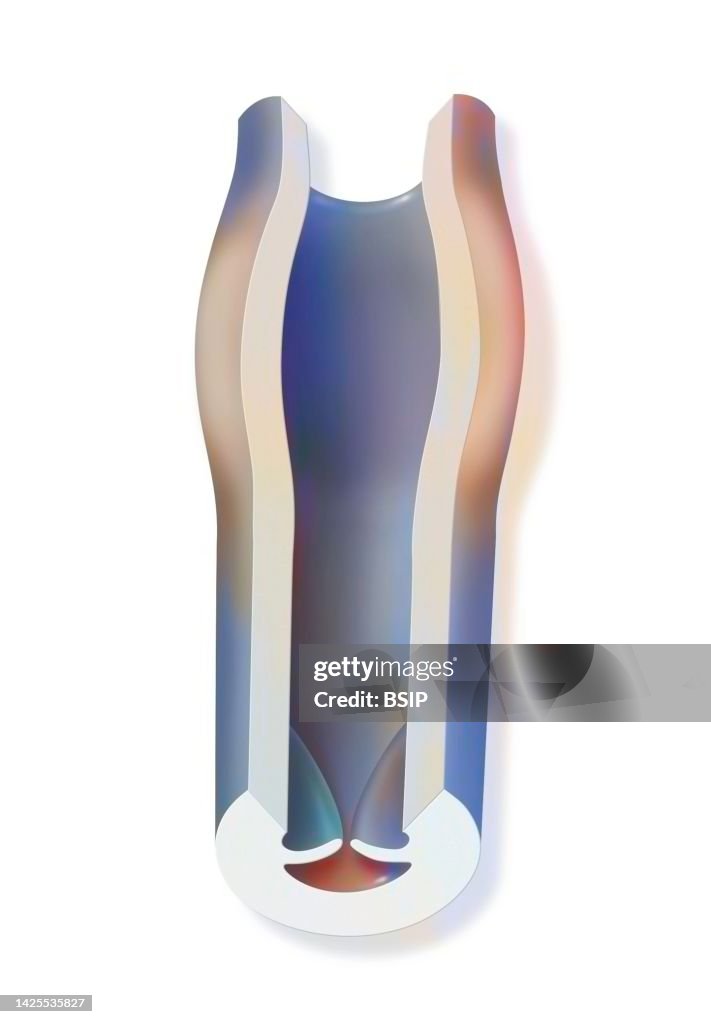 Varicose veins drawing