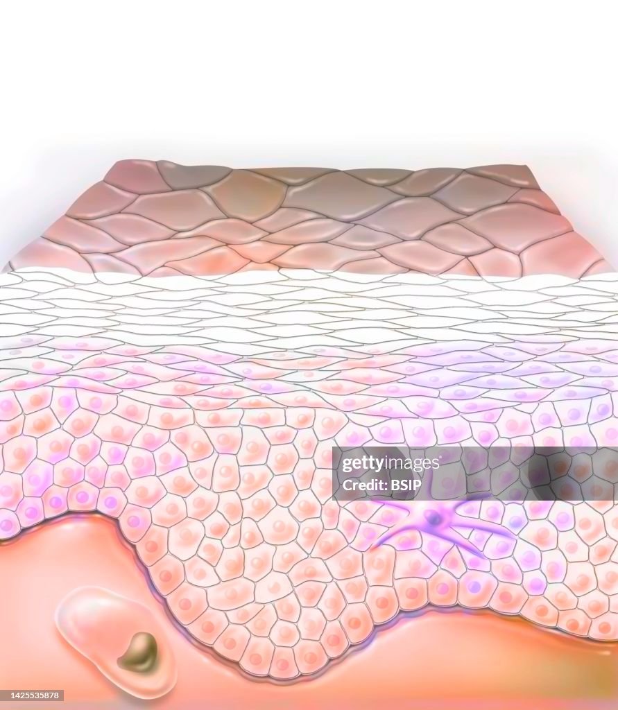 Skin drawing