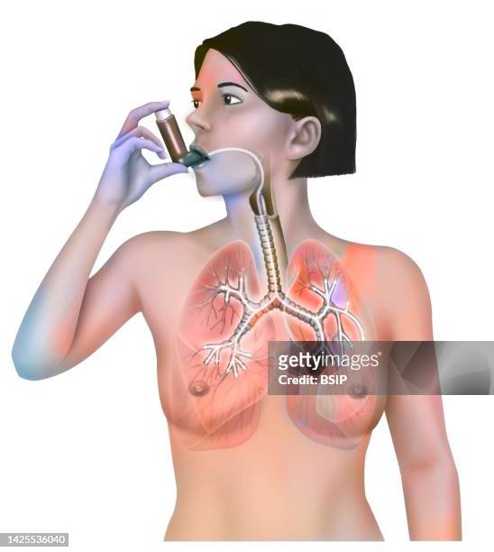 asthma treatment drawing - bronchien stock-grafiken, -clipart, -cartoons und -symbole