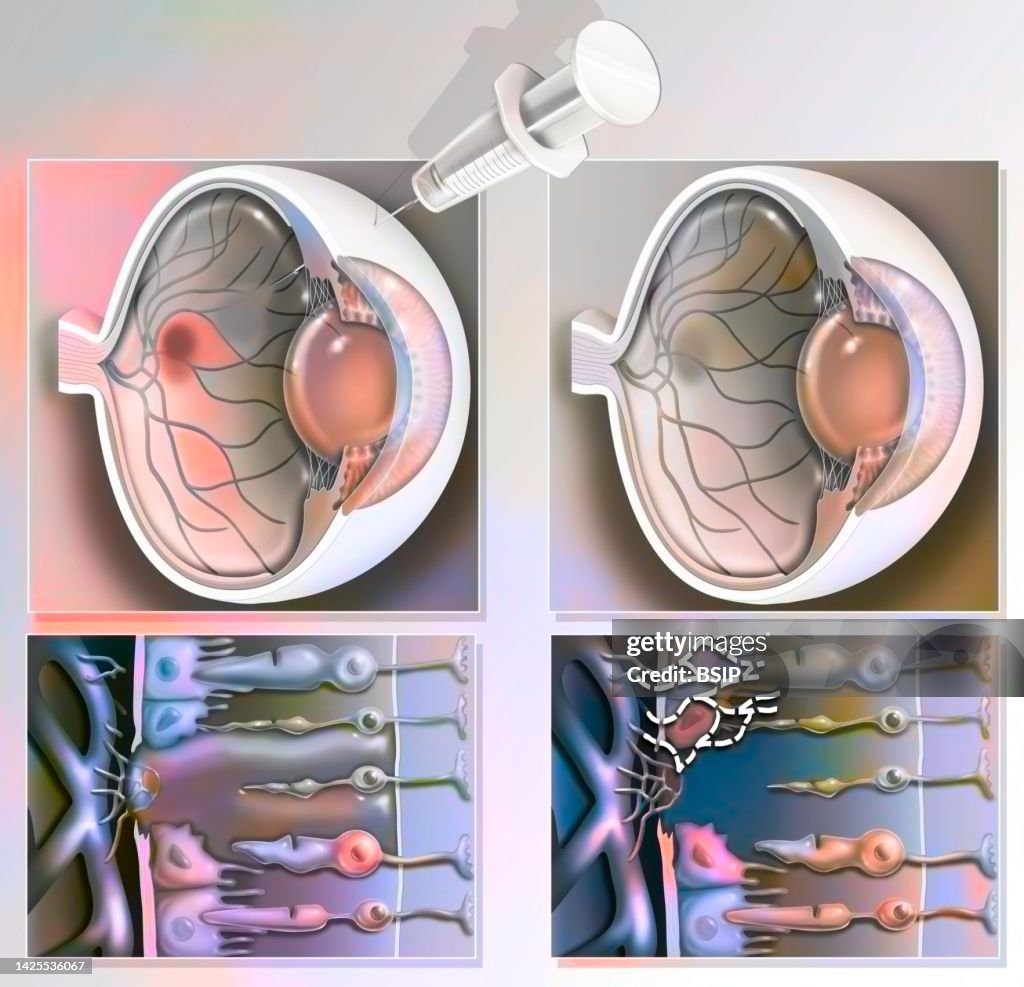 Dmla drawing processing