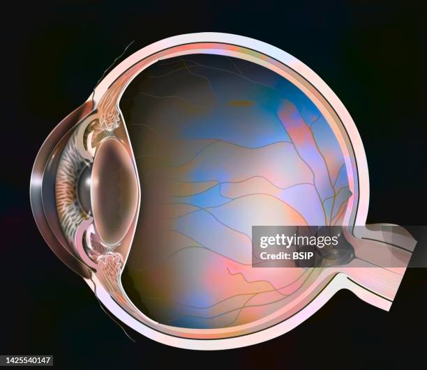 glaucoma drawing - glaucoma stock illustrations