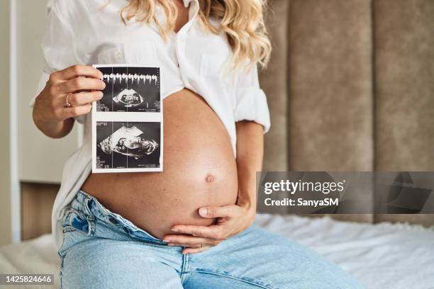 look at my baby! - twin ultrasound stock pictures, royalty-free photos & images