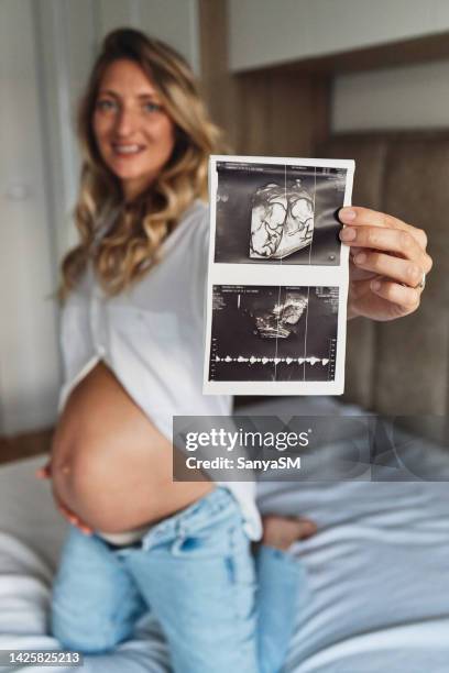 look at my twins! - twin ultrasound stock pictures, royalty-free photos & images