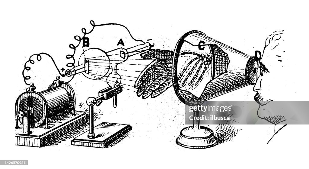 Antique illustration: X-ray experiment