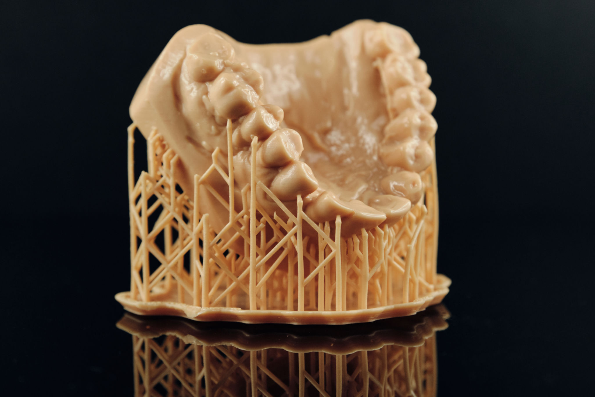 3D dental printing