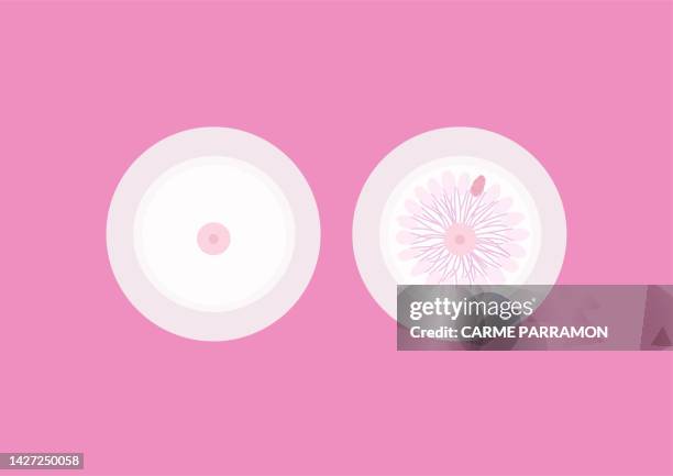 breast cancer - female reproductive organ stock illustrations