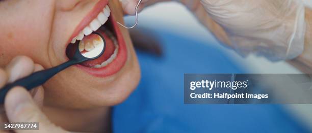 close-up of young woman at dental examination in an ambulance. - dental crown stock pictures, royalty-free photos & images