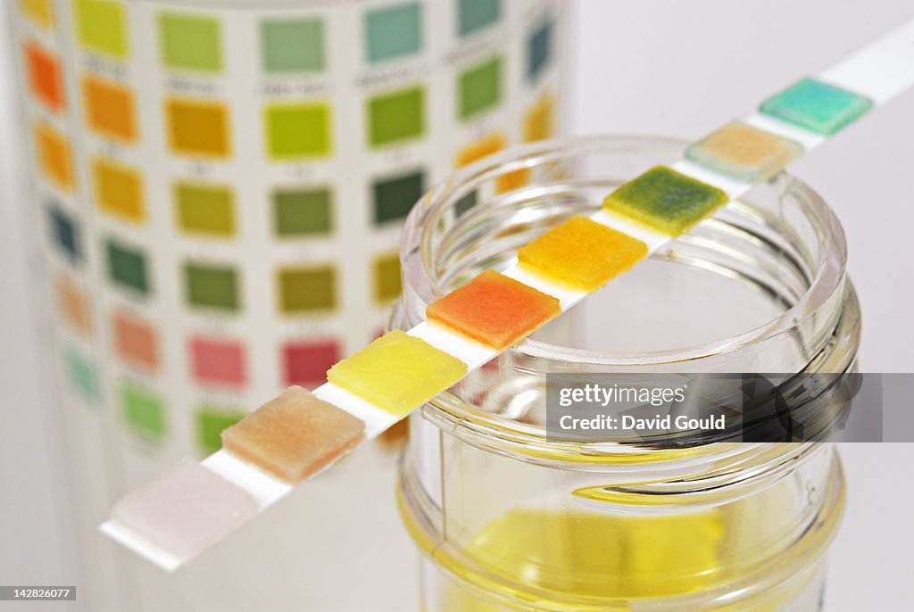 Urine sample test strip