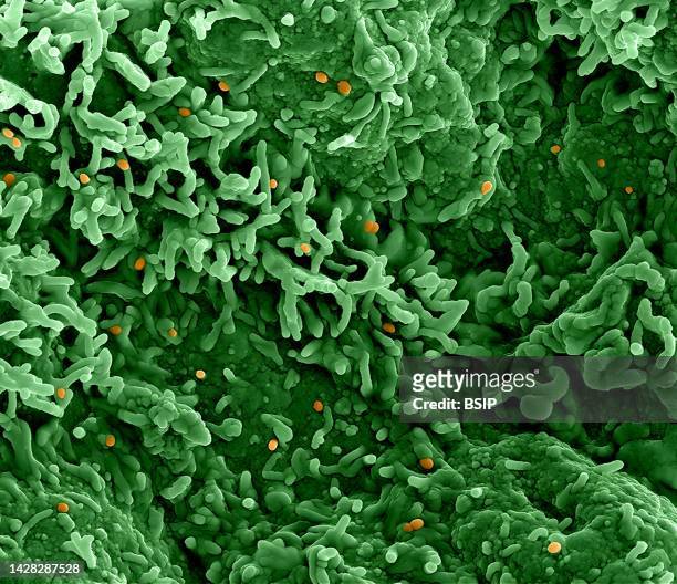 Colorized scanning electron micrograph of monkeypox virus on the surface of infected VERO E6 cells .