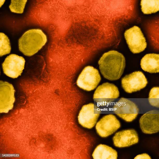 Colorized transmission electron micrograph of monkeypox virus particles cultivated and purified from cell culture.