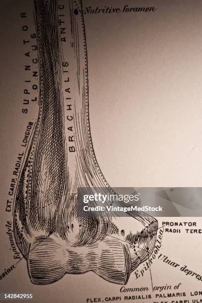 Medical drawing from 'A System of Human Anatomy Including its Medical and Surgical Relations' illustrates the human humerus, 1883.