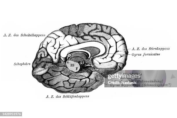 ilustraciones, imágenes clip art, dibujos animados e iconos de stock de hemisferio cerebral izquierdo - epilepsia