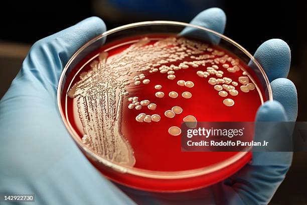 mrsa colonies on blood agar plate - boîte de pétri photos et images de collection