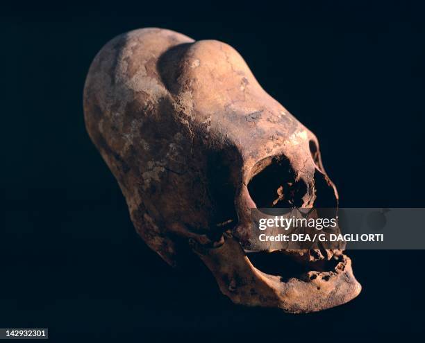 Indian skull showing a typical deformation, artefact from the Necropolis in Paracas . Pre-Inca Paracas Civilization, ca 10th Century BC. Lima, Museo...