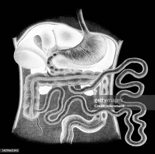 old chromolithograph illustration of the human abdomen, internal organs - 3d print food stock-fotos und bilder