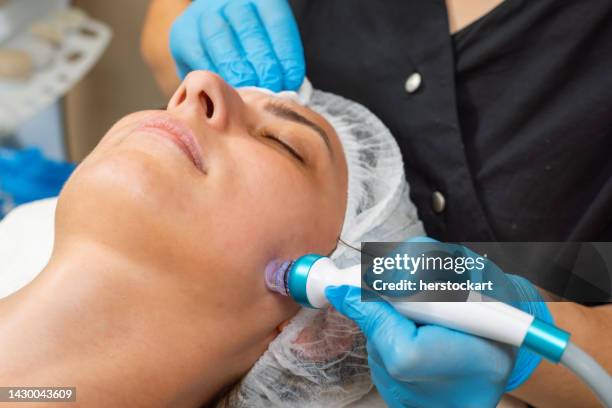expert dermatologist applying facial hydro microdermabrasion peeling treatment - peptide therapy stock pictures, royalty-free photos & images