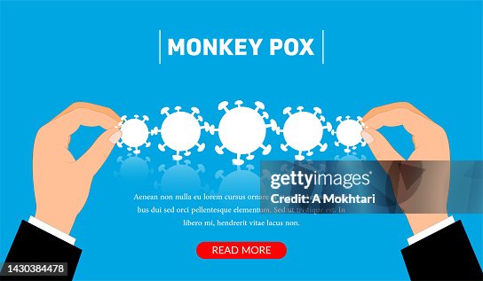 Help and support, Monkeypox Help and support, Monkeypox