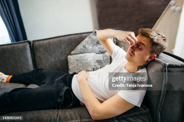 an exhausted, depressed man is lying on the couch alone, experiencing anxiety, stress, depression, loss of control - eisenmangel stock-fotos und bilder