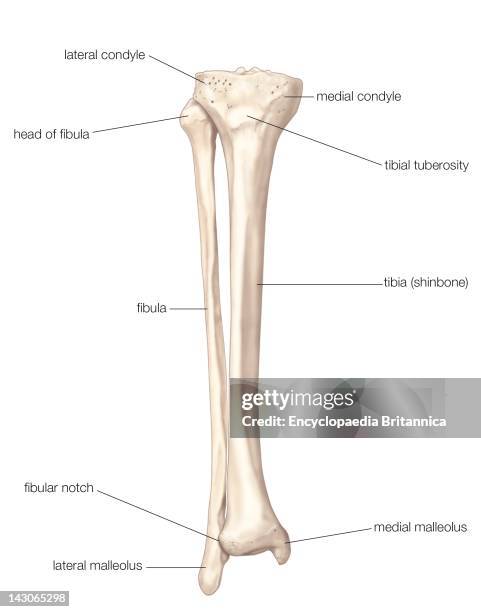 Fibula And Tibia, Anterior View Of The Bones Of The Lower Right Leg, The Fibula And The Tibia .