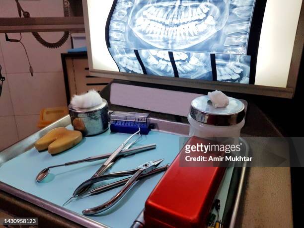 human teeth x-ray on light box. - pakistan hospital stock pictures, royalty-free photos & images