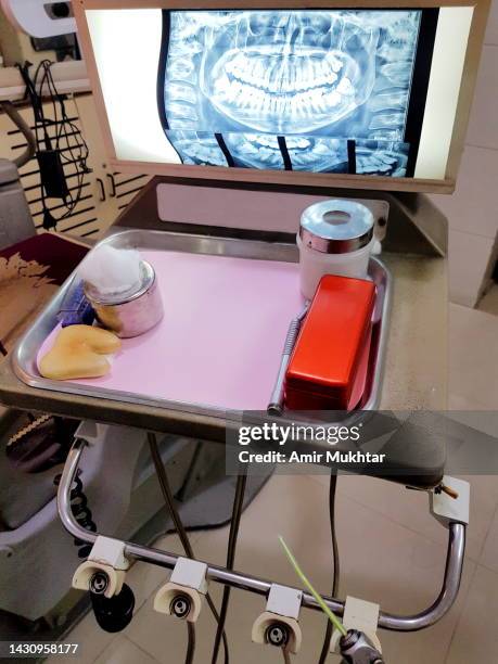 dental x-ray viewer unit system, medicine and surgical equipment. - pakistan hospital stock pictures, royalty-free photos & images