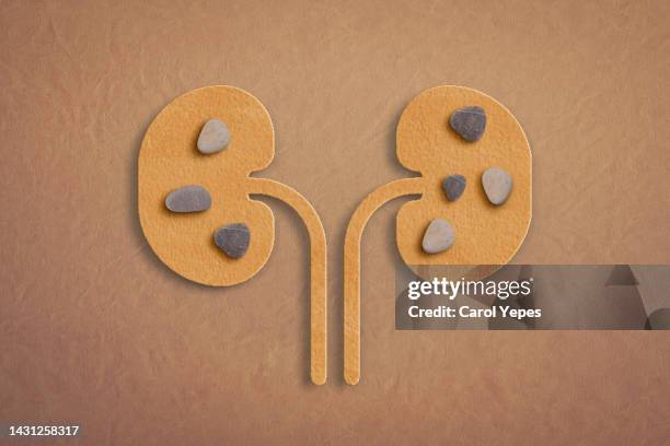 conceptual image stones in the kidney. - kidneys stock pictures, royalty-free photos & images