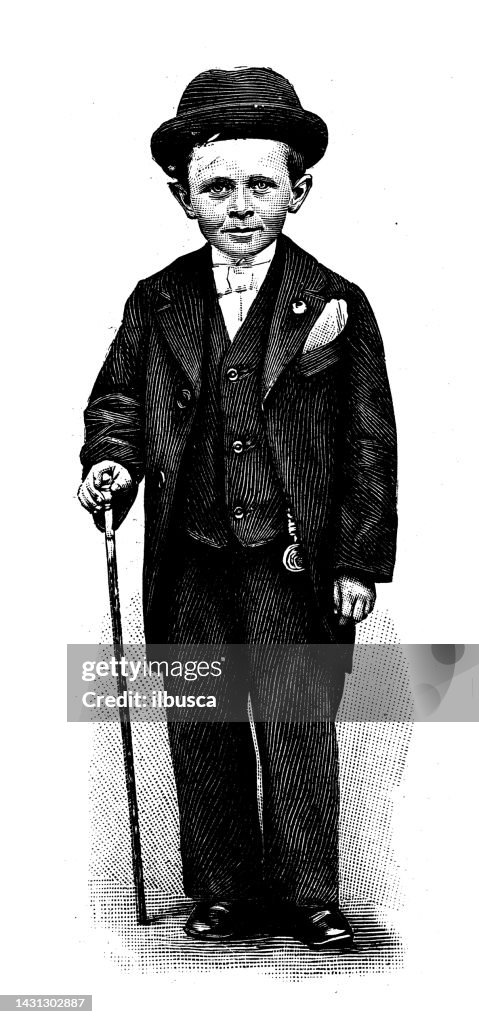Antique image: Dwarfism