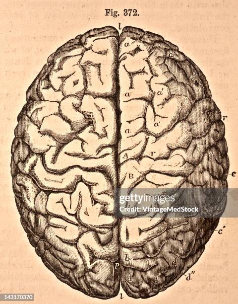 Medical illustration from 'Quain's Elements of Anatomy, Eighth Edition, Vol.II' depicts the upper surface of the brain , 1876. Visible are the...