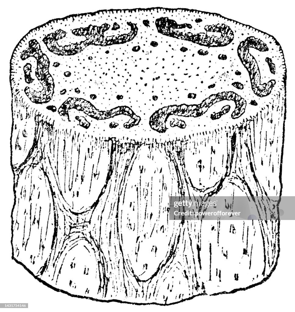 Saint Helena Tree Fern (Dicksonia Arborescens) Trunk Cross Section - 19th Century