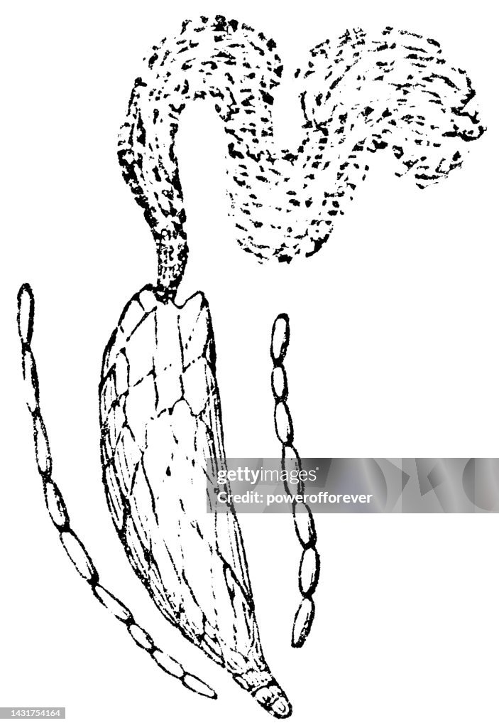Baby Tooth Moss Plant (Plagiomnium Cuspidatum) Antheridium and Thread Antherozoids - 19th Century