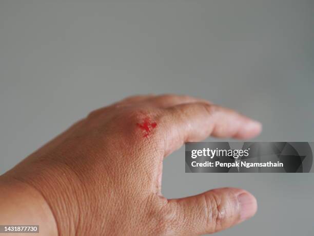 the hand was wounded by a knife. - hemorrhage stock pictures, royalty-free photos & images