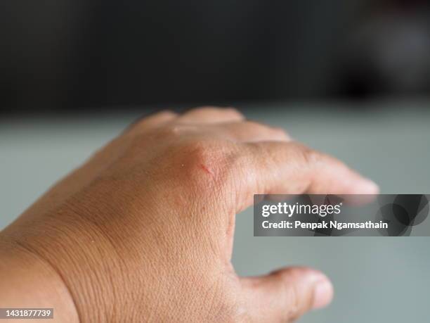 the hand was wounded by a knife. - schnittwunde stock-fotos und bilder