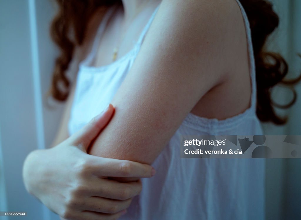 Teenage girl holding her arm that is covered in goosebumps