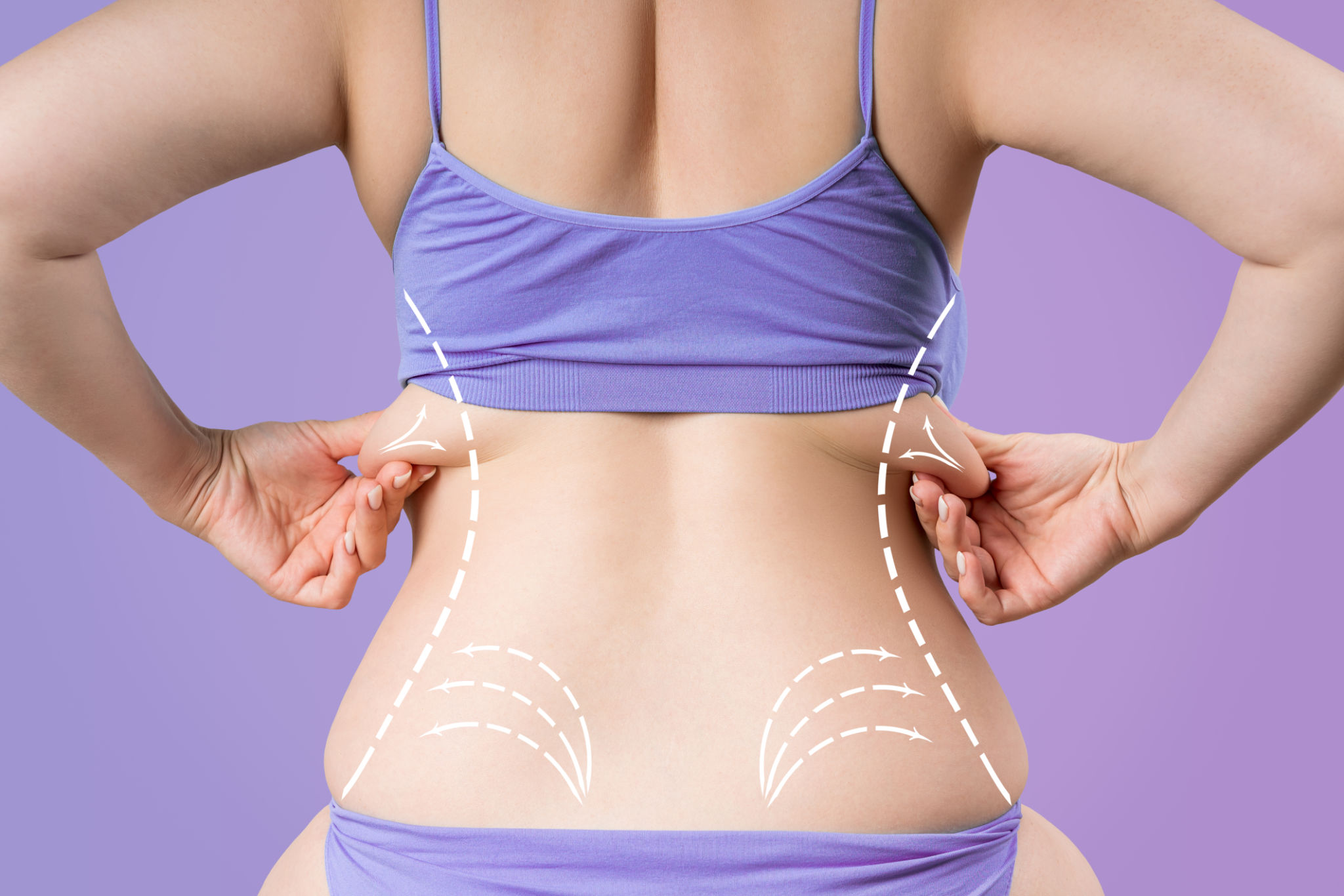 fat reduction treatment