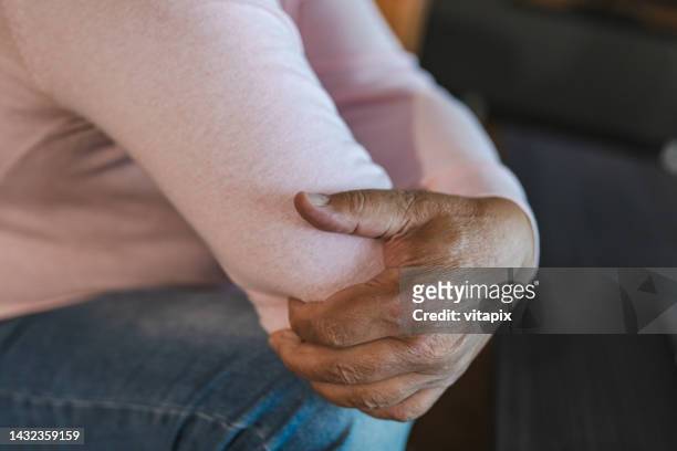 man holding elbow in pain - 肘 個照片及圖片檔
