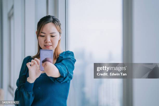 asian chinese woman with disability deformed arm checking text messages at home leaning on window - limb deformity stock pictures, royalty-free photos & images