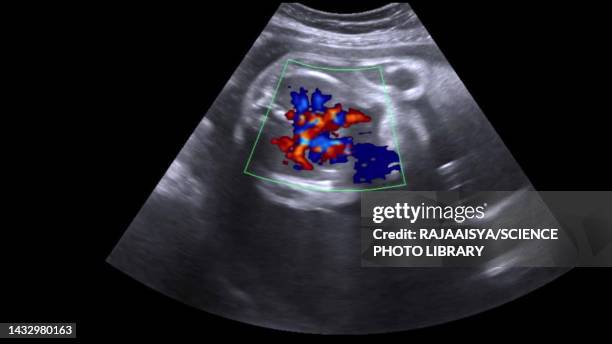 foetal heart, ultrasound scan - doppler stock pictures, royalty-free photos & images