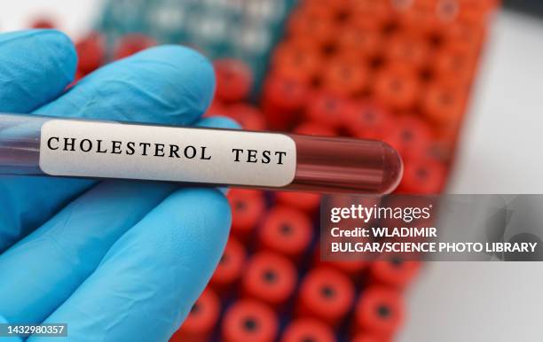 cholesterol blood test, conceptual image - cholesterin stock-fotos und bilder